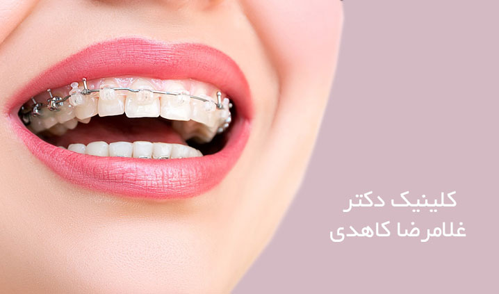 بهترین مرکز ارتودنسی در ونک